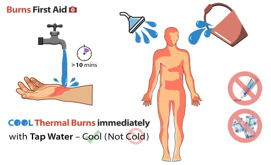 Cách xử lý khi bị bỏng acid